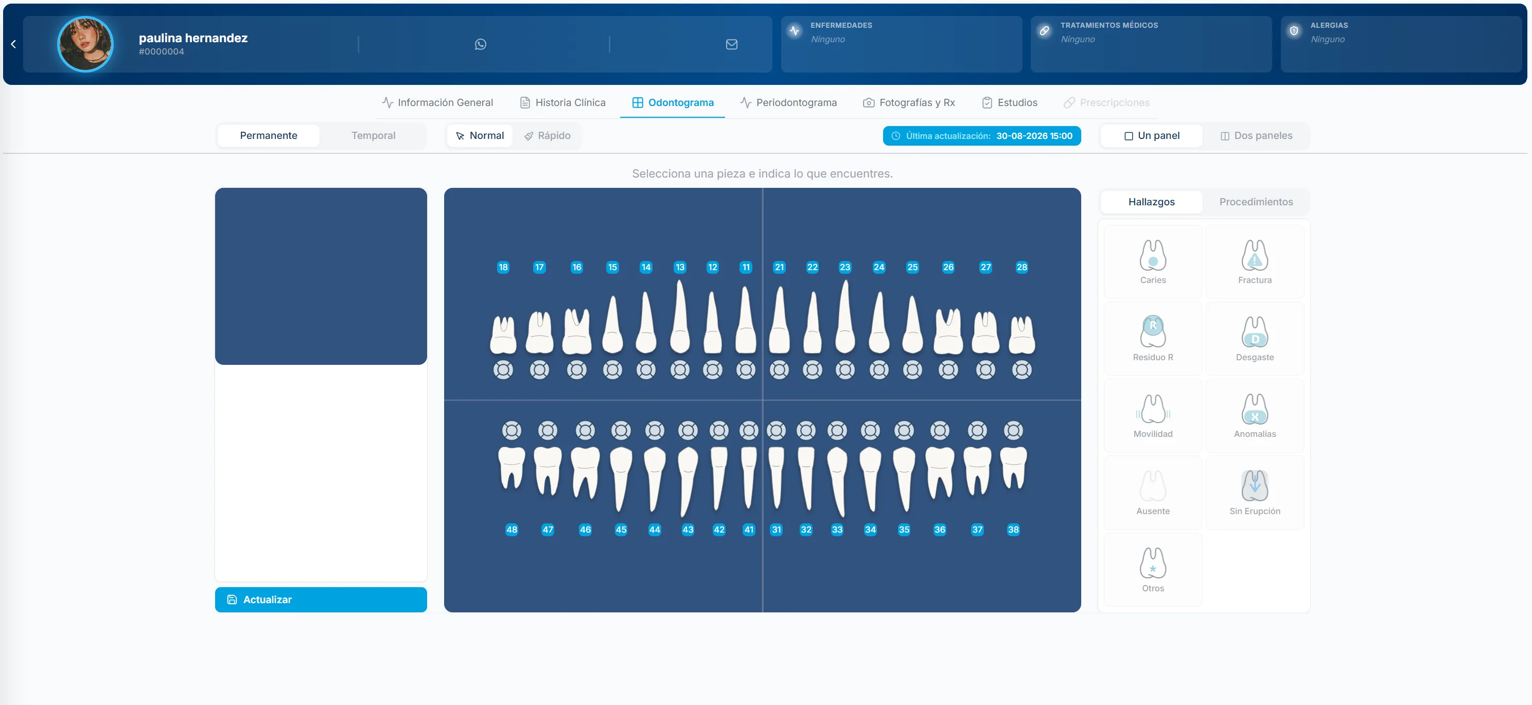 Captura del expediente clínico digital con odontograma interactivo de Dentana
